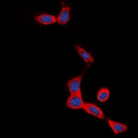 Anti-Secretin Receptor Antibody