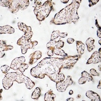 Anti-PEDF Antibody