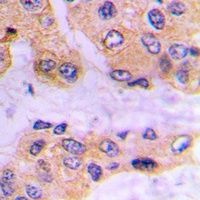 Anti-SMAD3 (Phospho-S213) Antibody