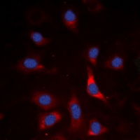 Anti-SMAD3 (Phospho-S213) Antibody