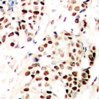 Anti-SNAI1 (Phospho-S246) Antibody
