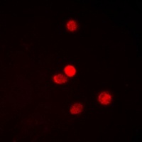 Anti-SNAI1 (Phospho-S246) Antibody