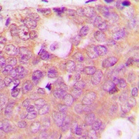 Anti-SPHK2 (Phospho-T614) Antibody
