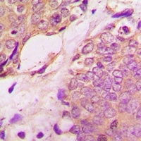 Anti-SREBP1 (Phospho-S439) Antibody