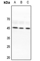 Lupus La Antibody