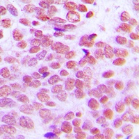 Lupus La antibody