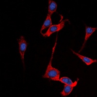 SSTR1 antibody