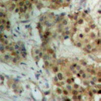 STAT4 (Phospho-Y693) antibody