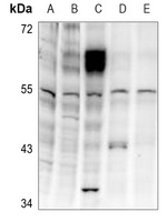 LKB1 (Phospho-T189) Antibody