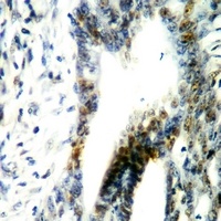 LKB1 (Phospho-T189) Antibody