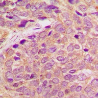 Anti-RB3 Antibody