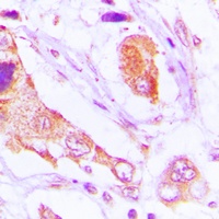 Anti-TAO1 Antibody