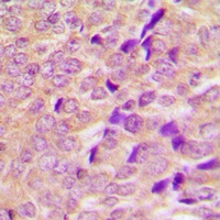 AS160 Antibody
