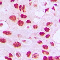 Telomerase (Phospho-S824) Antibody