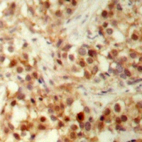 Anti-p53 (Phospho-S6) Antibody