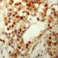 p53 (Phospho-S9) Antibody