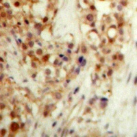 Anti-p53 (Phospho-S20) Antibody
