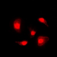 Anti-p53 (Phospho-S20) Antibody