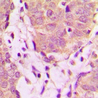 Anti-UBXN11 Antibody