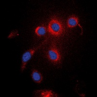 Anti-UBXN11 Antibody