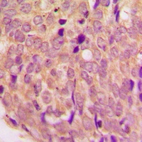 Anti-WASF1 Antibody