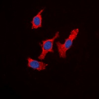 Anti-WASF1 Antibody