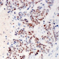 ZC3H4 antibody