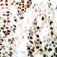 NIPA antibody