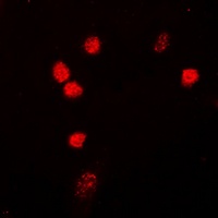 NIPA antibody