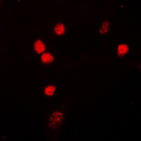 Anti-NIPA Antibody