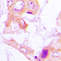 Anti-ACC alpha (Phospho-S80) Antibody