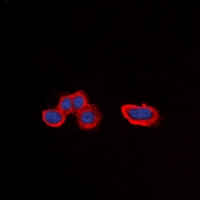 Alpha-1A Adrenergic Receptor Rabbit Polyclonal Antibody