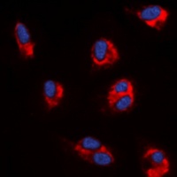 Anti-Angiopoietin-1 Antibody