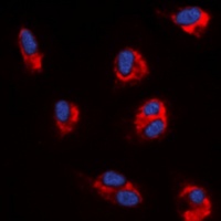 Angiopoietin-1 antibody