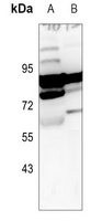 ARHGEF7 Antibody