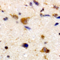 Anti-ARPP21 Antibody