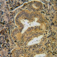 Anti-CD296 Antibody