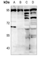 BCL6 Antibody