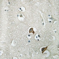 Anti-CCKAR Antibody