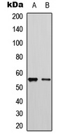 Cytochrome P450 2D6 Rabbit Polyclonal Antibody