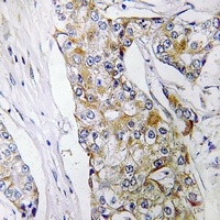 Anti-DHRS11 Antibody