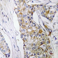 DHRS11 antibody