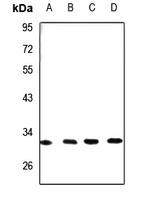 DHRS4 Antibody