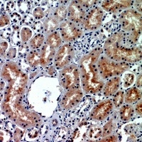 CD26 Antibody