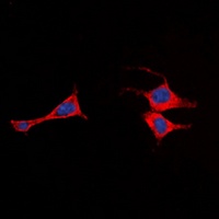 Anti-EMR2 Antibody