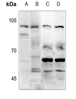 CD203c Rabbit Polyclonal Antibody
