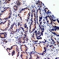Anti-CD203c Antibody