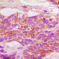 Anti-HER2 (Phospho-Y1248) Antibody
