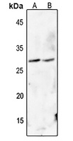 FADD (Phospho-S194) Antibody