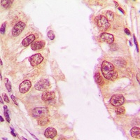 FADD (Phospho-S194) Antibody